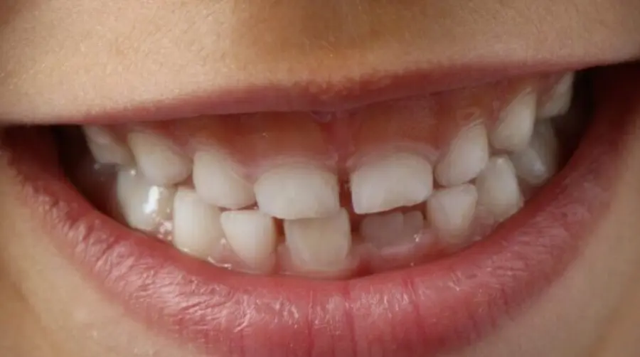 I migliori spazzolini elettrici della Oral B